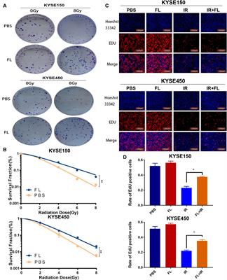 FMS-Related Tyrosine Kinase 3 Ligand Promotes Radioresistance in Esophageal Squamous Cell Carcinoma